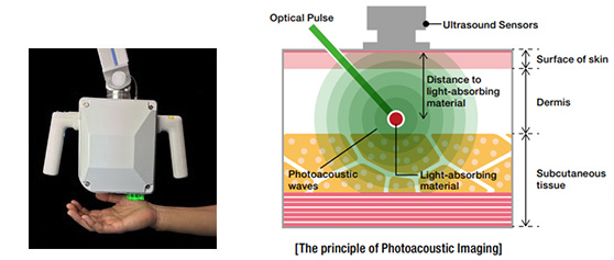 The principle of Photoacoustic Imaging