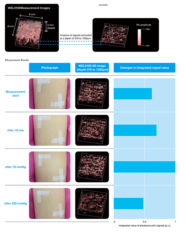 Case study：measurement of blood circulation change in forearm after application of pressure