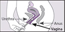 OMNIgene®・VAGINAL 検体採取方法 2