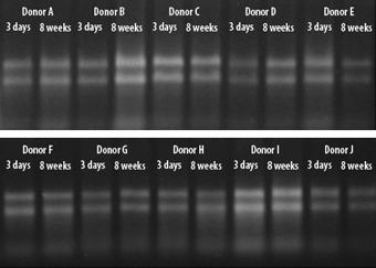 表：遺伝子解析用RNA採取キットOragene・RNA（オラジーン）によるリアルタイムPCR