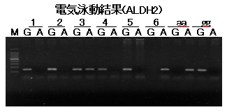 画像：電気泳動結果（ALDH2）